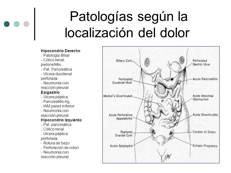 Izquierdo flanco dolor en